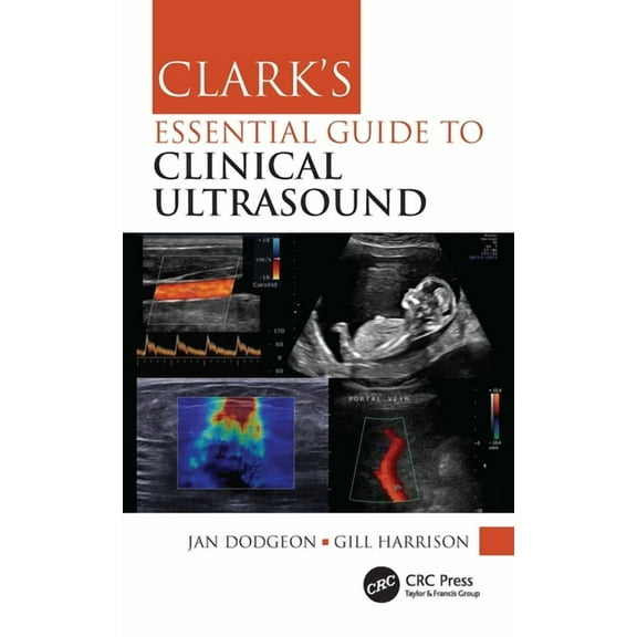 Clark's Companion Essential Guides Clark's Essential Guide to Clinical Ultrasound, (Paperback)