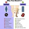 thumbnail image 2 of HLONK Closed Toe Sheer Compression Stockings for Women  15-20 mmHg Knee High Circulation Support Stockings  Graduated Medical Compression Socks for Travel  Flight, 2 of 7