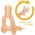 thumbnail image 2 of KAIYANG Protector de silicona ajustable para el pulgar que evita que los niños se chupen el dedo (0 a 3 años), 2 of 5