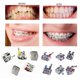 thumbnail image 3 of Soporte Dental, Soportes para Aparatos OrtopéDicos, 10 Juegos 100 Piezas Dientes de Aparatos OrtopéDicos Modelo Mini 022 Ranura 345, 3 of 3