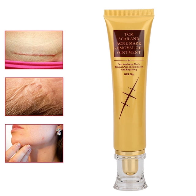 Gel Para Eliminar Cicatrices Gel Para Reparar La Piel Gel Anticicatrices Tratamiento De Estrías Pomada Para Eliminar Cicatrices 30g Gel Para Eliminar Cicatrices De Marcas De Acné ANGGREK Otros