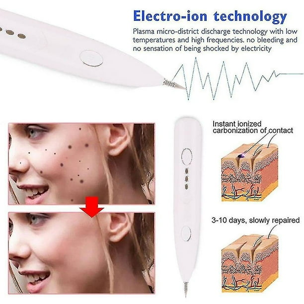Mini Plasma Pen Remove Pen Wart Remover Mole Remover Use Ces