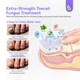 thumbnail image 5 of SAVILAND Toenail Fungus Treatment Extra Strength: 2X Extreme Nail Repair for Discolored and Damaged Nails Toenail Softener Yellow Toenail Foot Toe Thick Nail Fungus Treatments Solution,1 fl oz, 5 of 10