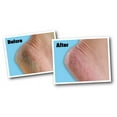 thumbnail image 1 of O'Keeffe's For Healthy Feet Foot Cream-3oz, 1 of 2