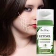 thumbnail image 1 of Xihbxyly Cortaúñas de Acero Inoxidable para Uñas Gruesas, con Recogedor de Uñas Integrado, Mecanismo de Corte Fácil, Ideal para El Cuidado Personal En Casa, Ideal para Personas Mayores, Incluye Estuc, 1 of 4