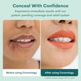 thumbnail image 6 of Coverology Cold Sore Treatment & Concealer Cream, Medium Shade, 6 of 9