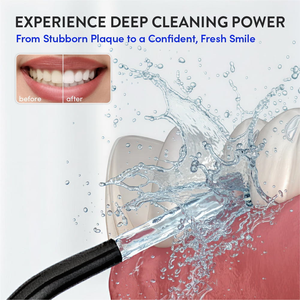 Éclat Portable Electric Waterproof Water Flosser for Deep Teeth Cleaning - 300ML Tank, USB-C Rechargable, Long Lasting 30 Day Charge, 4 Accessories Included BPA Free (Black)