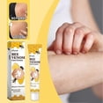 thumbnail image 2 of portable anti-itch cream for vitiligo skin care, 2 of 5