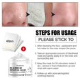 thumbnail image 3 of Mascarilla para eliminar puntos negros, mascarilla para la nariz, tira para los poros, mascarilla negra para rasgar, exfoliante, unisex, limpieza profunda de la piel, 3 of 5
