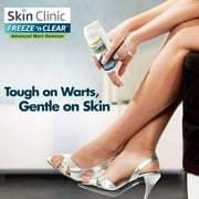 Skin Clinic FREEZE n CLEAR™ Advanced Wart Remover, Tough on Warts, Gentle on Skin, (12 Applicators)