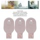 thumbnail image 3 of Bolsa De Ostomía Anorrectal, Tela No Tejida Seca Y Transpirable, 10 Piezas De Bolsas De Colostomía Ligeras Para La Vida Diaria O Uso En Viajes, 3 of 7