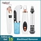 thumbnail image 2 of Beauty Electric Blackhead Remover Limpiador facial Punto negro Succión al vacío Black Head Dots Remover Extractor Cuidado de la piel Herramientas Tan Jianjun unisex, 2 of 2