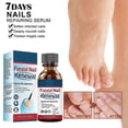 thumbnail image 2 of Nail Toenail Extra Strong Nail Repair Set Fingernail Toenail Care Fix Damaged Broken Nail Repair 10ml, 2 of 5