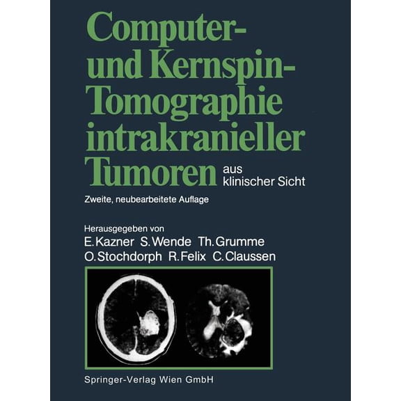 Computer- Und Kernspin-Tomographie Intrakranieller Tumoren Aus Klinischer Sicht, (Paperback)