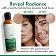 thumbnail image 2 of Prive Scalp Reboot Serum 1.7 Fl Oz Tratamiento nutritivo y calmante para el cuero cabelludo para una salud óptima del cuero cabelludo, 2 of 5