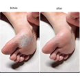 thumbnail image 5 of 4 Pcs Lime à Pied Double Face Exfoliant Pédicure Outils de Pédicure, 5 of 5