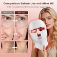 thumbnail image 5 of Morfone Red Light Therapy for Face & Neck, 7-in-1LED Face Mask with 850nm & 660nm NIR, Cordless Infrared Lights Masks for Home Working Travel Yoga Sleep, 5 of 10