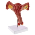 thumbnail image 2 of 1:1 Human Female Uterus Ovary Fallopian Tubes Model Anatomical Human Anatomy Model Teaching Tools, 2 of 8