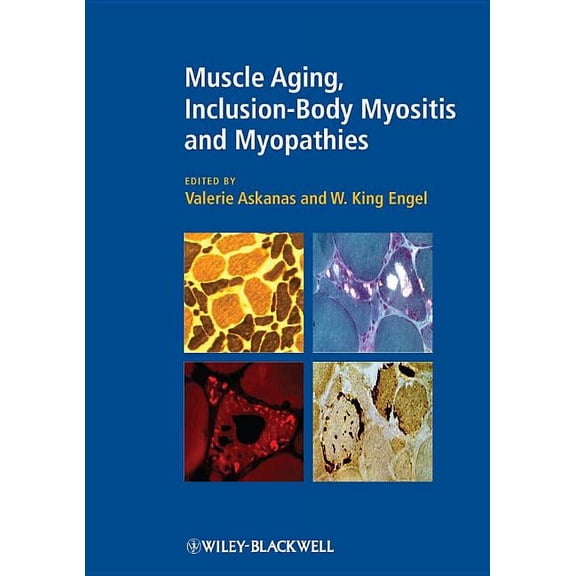 Muscle Aging, Inclusion-Body Myositis and Myopathies, (Hardcover)