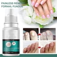 thumbnail image 1 of Solución para el cuidado de las uñas: repara, fortalece, aclara, hidrata y limpia las uñas, 10 ml, 1 of 6