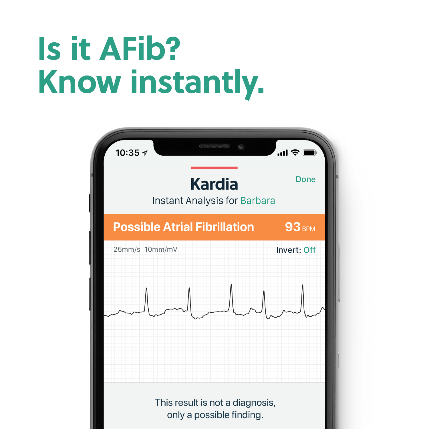 AliveCor KardiaMobile FDA Cleared 1-Lead Personal EKG Monitor – Detects AFib  and Irregular Arrhythmias – Instant Results in 30 Seconds – Easy to Use – Works  with Most Smartphones