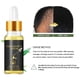 thumbnail image 2 of Suero de Hierbas Espesante de biotina ANGGREK Aceite de Suero de crecimiento Rápido del cabello 20 ml, 2 of 8