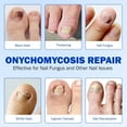 thumbnail image 3 of Fungal Nail Patches for Toenails, 21pcs/Bag Toenail Fungus Treatment Extra Strength, Nighttime Nail Repair for Damaged, Discolored Nails, Safe for Sensitive Skin, Easy to Apply, 3 of 8