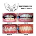 thumbnail image 2 of Protector bucal para rechinar los dientes - Nuevo protector bucal para apretar los dientes en las paradas invisibles del protector nocturno dental (paquete de 3), 2 of 5
