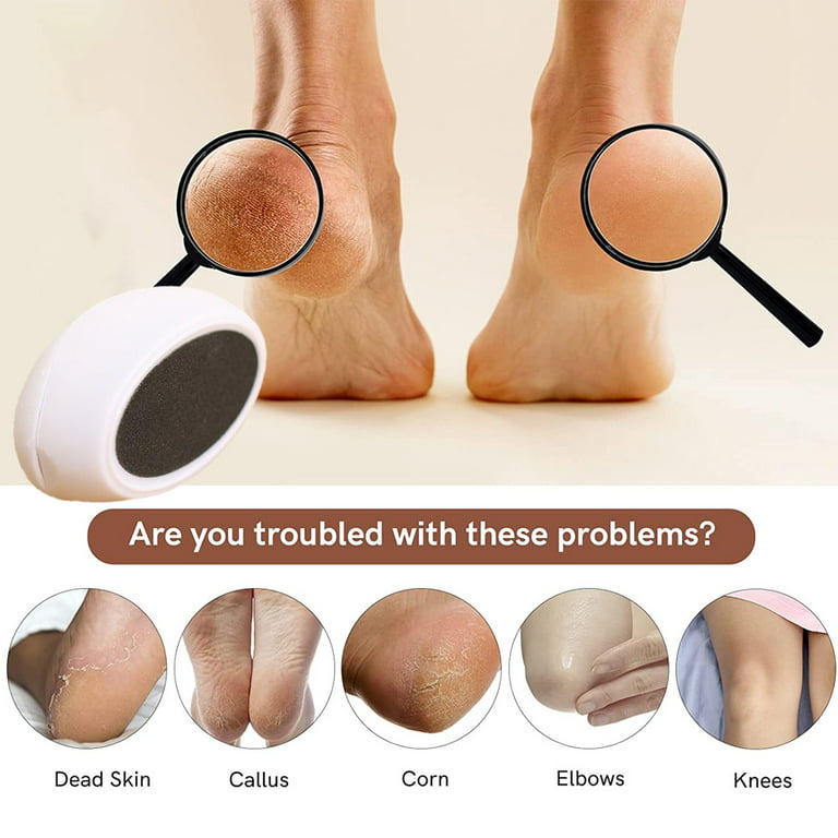 Creative Egg Foot Scrubber Heel Scraper for Dead Skin Removal, Foot Buffer  Shower Pedicure Tool for Men, Women, Soft Feet Care 