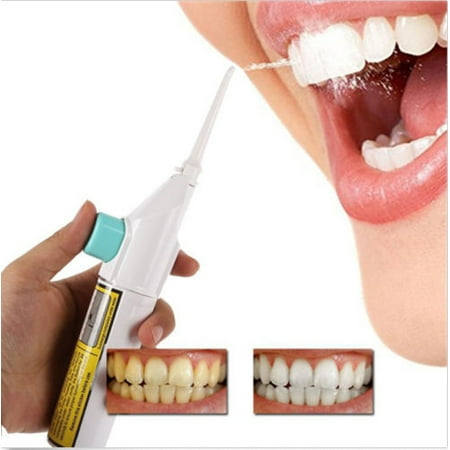 Power Flosser - Tuscom Portable Power Floss Dental Water Jet Cords Tooth Pick Braces No Batteries