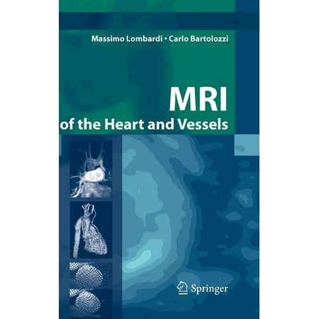 UPC: 9788847003064 | MRI of the Heart and Vessels (Hardcover)