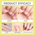 thumbnail image 4 of Radiant Nail Growth Oil, Anti Fungus Nail Strengthener Brightening Nail Growth Repair Oil for Toenails and Fingernails, 4 of 5