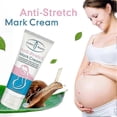 thumbnail image 5 of 2pcs Removes Stretch Mark Cream Pregnant Women Repair Anti-aging Anti-winkles Cream Increase Skin Elasticity Smooth Firm Skin Care, 5 of 5