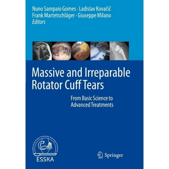 Massive and Irreparable Rotator Cuff Tears: From Basic Science to Advanced Treatments, (Paperback)