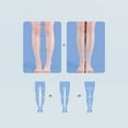 thumbnail image 7 of Supination Insoles For Over Supination High Arch Support,orthotic Inserts For Foot Alignment, Knock Knee Pain, Bow Legs, O/X Type Leg, 7 of 7