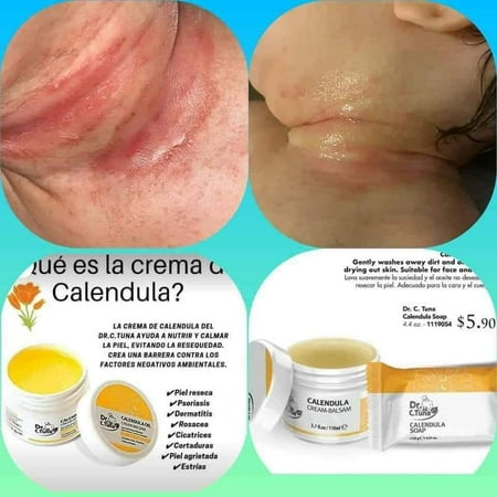 FARMASI CREMA DE Calendula Oil Cream – Multipurpose Ointment – Double Moisturizer for Burns – Hydrating & Calming Sensitive Skin Cream –