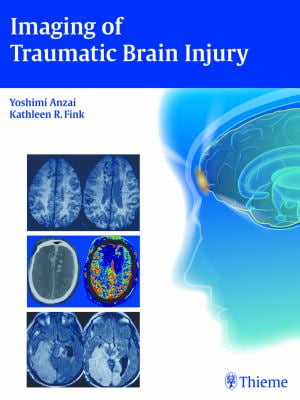 Imaging Of Traumatic Brain Injury - Walmart.com