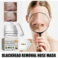 Get Rid Of Big Blackheads Naturally: Our Top 5 Recommendations - figii3i