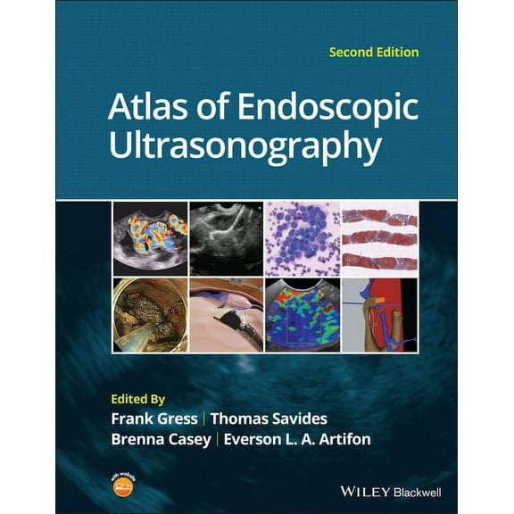 Atlas of Endoscopic Ultrasonography (Hardcover)
