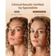 thumbnail image 4 of Mascara de Terapia de Luz Roja RENPHO 2026 con 324 LEDs para Rostro, 4 of 9