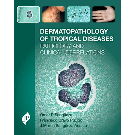 UPC: 9781909836068 | Dermatopathology of Tropical Diseases (Hardcover)