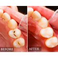thumbnail image 4 of Dental Pick Double Ended Professional Dental Scraper Stainless Steel for Teeth Cleaning Hygiene Tool for Tartar and Plaque Remover, Teeth Cleaning at Home 2 PC, 4 of 8