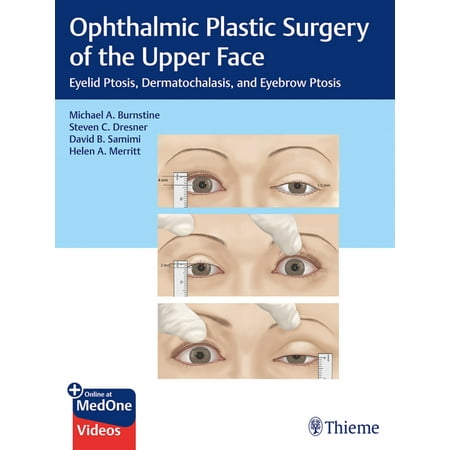 UPC: 9781626239210 | Ophthalmic Plastic Surgery of the Upper Face: Eyelid Ptosis  Dermatochalasis  and Eyebrow Ptosis (Hardcover)