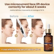 Flaremore Double Chin Reducer Machine, Portable Intelligent V-Face Shaping Massager, Shaped Slimming Face Mask Double Chin Reducer V Line Lifting for Firming and Tightening Skin Care,White