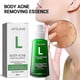 thumbnail image 1 of Jaysuing Anti-Acne Whitening Essence Fades Acne Spots and Marks Moisturizing Whitening Skin Care Essence BF, 1 of 5