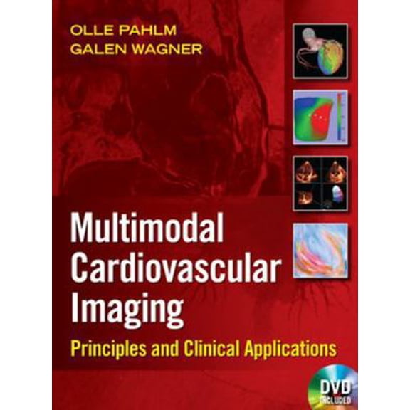 Pre-Owned Multimodal Cardiovascular Imaging: Principles and Clinical Applications Paperback