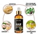 thumbnail image 2 of 3pcs Ginger Germinal Oil Plant Essential Oil Hair Nutrient Solution Hair Growth Essence Liquid, 2 of 3