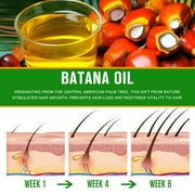 Mooyam 3 Pack Batana Oil-Natural Conditioner-Moisturizes Hair & Scalp-100% Pure & Natural Organic Essential Oil for Hair,Skin- 6.06 fl.oz