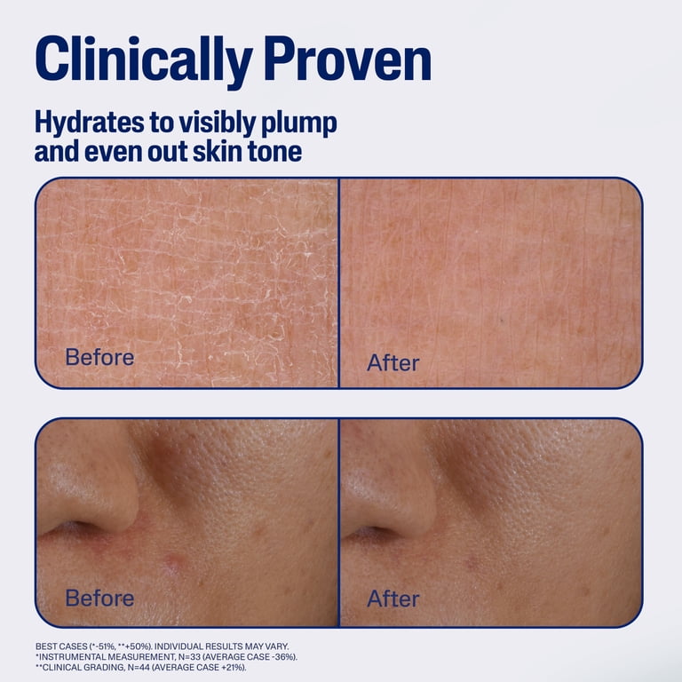 Cetaphil Repair & Renew PM Face Serum For Sensitive Skin photo 4