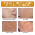thumbnail image 3 of Vitamin C Anti-Aging Serum, Desalination spot wrinkle firming moisturizing facial skin anti-wrinkle cream, 3 of 5